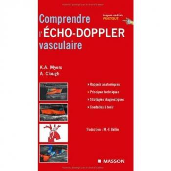 Comprendre L'écho-Doppler Vasculaire