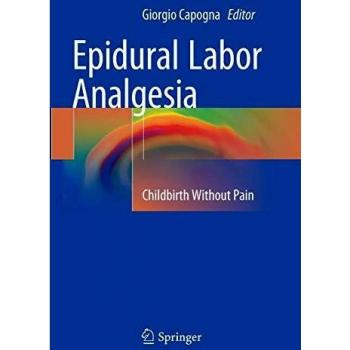 Epidural Labor Analgesia