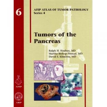 Tumors of the Pancreas