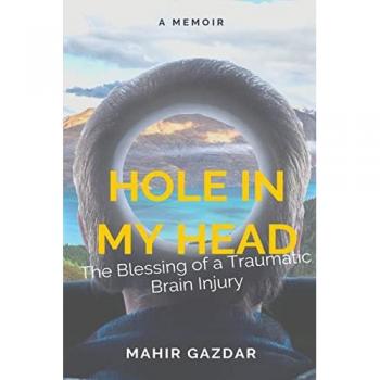 Hole in My Head