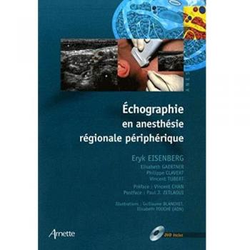 Eryk Eisenberg Echographie En Anesthesie Régionale Périphérique (1dvd)
