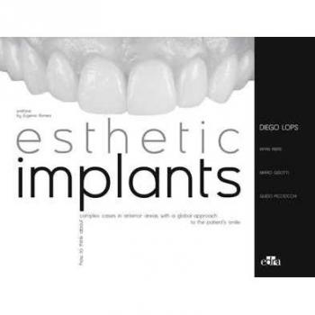Esthetic implants. How to think about complex cases in anterior areas with a global approach to the patient' s smile