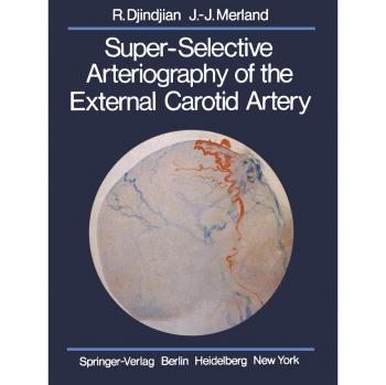 Super-Selective Arteriography of the External Carotid Artery