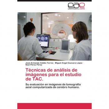 Técnicas de análisis de imágenes para el estudio de TAC.: Su evaluación en imágenes de tomografía axial computarizada de cerebro humano.