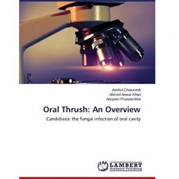 Oral Thrush: An Overview: Candidiasis: the fungal infection of oral cavity