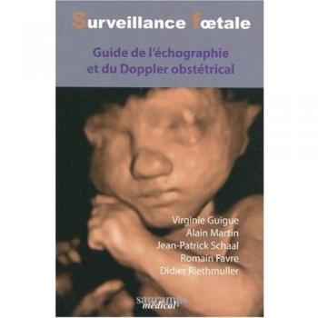 Surveillance foetale : Guide de l'échographie et du Doppler obstétrical