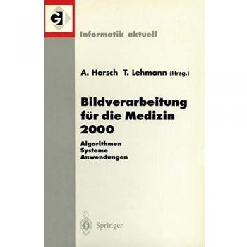 Bildverarbeitung für die Medizin 2000: Algorithmen