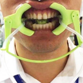 Traje de Unión Denxy Retractor Dental