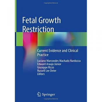 Fetal Growth Restriction