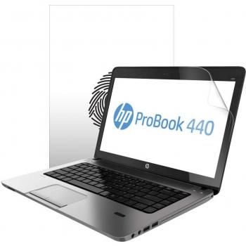 UltraLite Vivid Film – Compatible with HP ProBook 440 G1 (Set of 2)