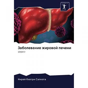 Заболевание жировой печени: Цирроз: Cirroz