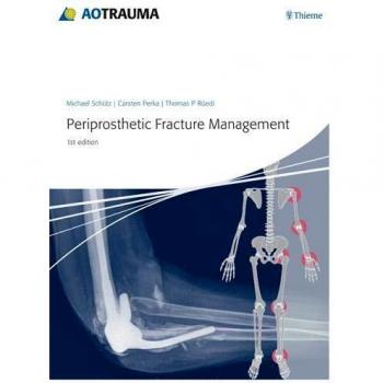 Thieme Medical Publishers Periprosthetic Fracture Management
