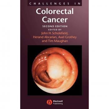 Challenges in colorectal cancer 2e hardcover