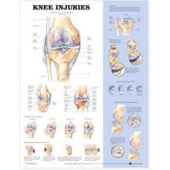 Knee Injuries Anatomical Chart, Paperback by Anatomical Chart Company (EDT), ...
