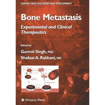 Bone Metastasis: Experimental and Clinical Therapeutics