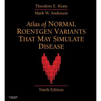 Vitalsource Technologies, Inc. Atlas Of Normal Roentgen Variants