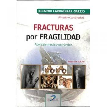 Fracturas por fragilidad: Abordaje médico quirúrgico (Tapa blanda).