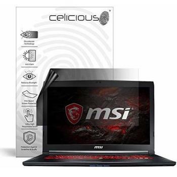 VigilantScreen 2‑Way Privacy & Anti‑Glare Film for MSI GL72M 7REX