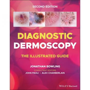Jonathan Bowling Diagnostic Dermoscopy