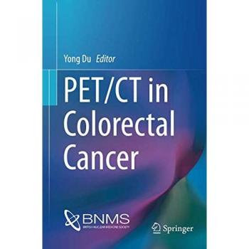 PET/CT in Colorectal Cancer (Clinicians’ Guides to Radionuclide Hybrid Imaging)