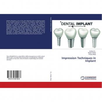 Impression Techniques in Implant