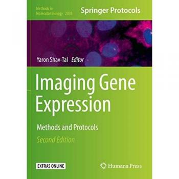 Imaging Gene Expression: Methods and Protocols (Methods in Molecular Biology, Band 2038)