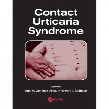 Vitalsource Technologies, Inc. Contact Urticaria Syndrome