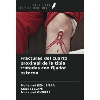 Ben Jemaa, Mohamed: Fracturas del cuarto proximal de la tibia tratadas con fijador externo