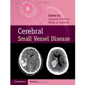 Cerebral Small Vessel Disease