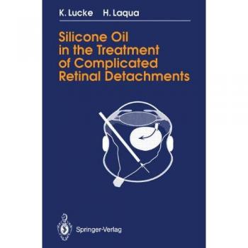 Silicone Oil in the Treatment of Complicated Retinal Detachments: Techniques, Results, and Complications