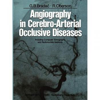 Angiography in Cerebro-Arterial Occlusive Diseases