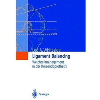 Ligament Balancing: Weichteilmanagement in der Knieendoprothetik