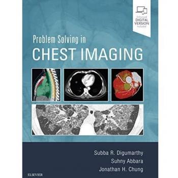 Problem solving in chest imaging