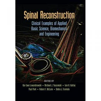 Spinal Reconstruction: Clinical Examples of Applied Basic Science, Biomechanics and Engineering