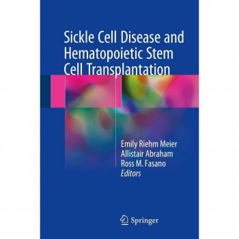 Sickle Cell Disease and Hematopoietic Stem Cell Transplantation