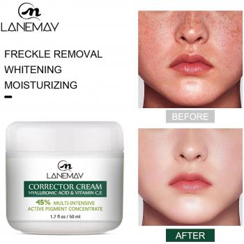 Tote Kakanwo Cuidado de Piel: Crema 50g y Remover Pecas