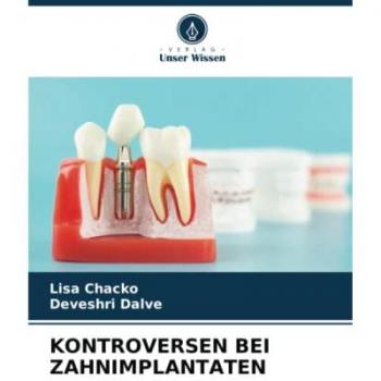 Chacko, Lisa: KONTROVERSEN BEI ZAHNIMPLANTATEN