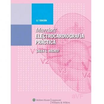 Marriott. Electrocardiografía práctica