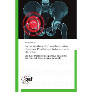 La reconstruction acétabulaire dans les Prothèses Totales de la Hanche: Conduite thérapeutique pratique devant les pertes de substance osseuse du cotyle