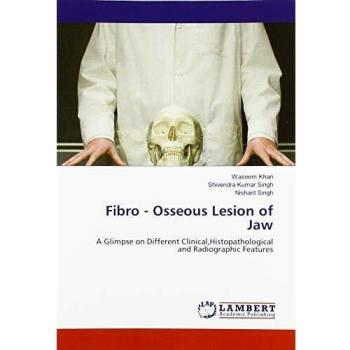 Fibro