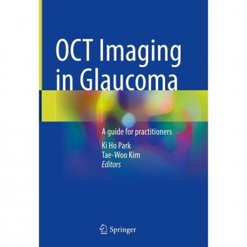 OCT Imaging in Glaucoma