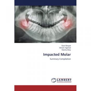 Impacted Molar: Summary Compilation