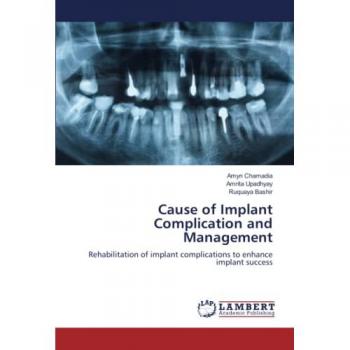 Chamadia, Amyn: Cause of Implant Complication and Management