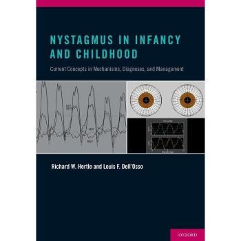 Nystagmus in Infancy and Childhood