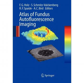 Atlas of Fundus Autofluorescence Imaging