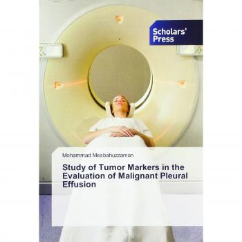 Study of Tumor Markers in the Evaluation of Malignant Pleural Effusion