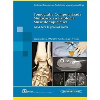 TC Multicorte Patol. Musculo esque: Guía para la práctica diaria.