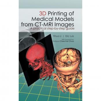 Li Yihua: 3D Printing of Medical Models from CT-MRI Images