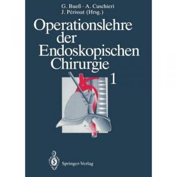 Operationslehre der Endoskopischen Chirurgie 1: Band 1