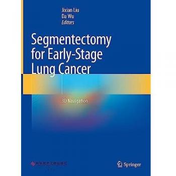 Segmentectomy for Early-Stage Lung Cancer: 3D Navigation